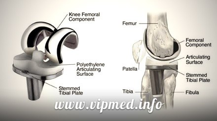 ������� �������������� ����� � ��������