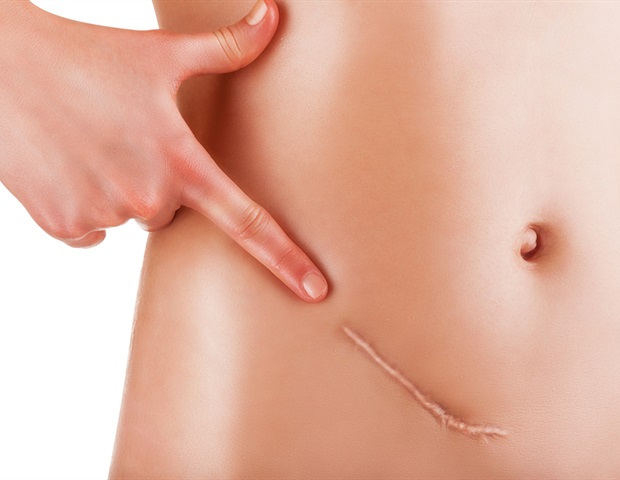 ������������ ������������, ��� OVCAR3 �������� ������� ��������� ���� �������� ������� ������� �����������������