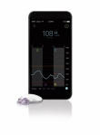 Medtronic представила инновационную мобильную систему мониторинга глюкозы для людей с диабетом