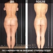 Ручная Пластика В чем уникальность метода?!
