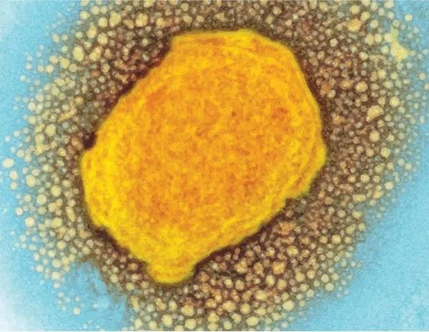 Исследование: 35% положительных ПЦР‑тестов на mpox в ДРК могли быть ложными из‑за загрязнения