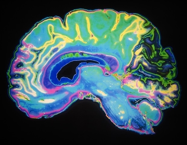 Гистаминовые нейроны мозга контролируют ежесекундную доступность памяти