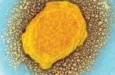 Исследование: 35% положительных ПЦР‑тестов на mpox в ДРК могли быть ложными из‑за загрязнения