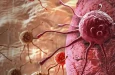 Облучение тимуса связано с худшими исходами при немелкоклеточном раке лёгкого