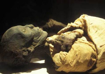 Атеросклероз у древних египтян мог быть вызван инфекциями