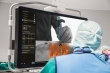 Philips представляет первую в мире технологию хирургической навигации с использованием дополненной реальности