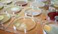 Эффективность микробиологических экспресс-тестов